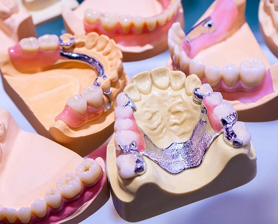 Series of dentures in Cherry Hill resting on molds