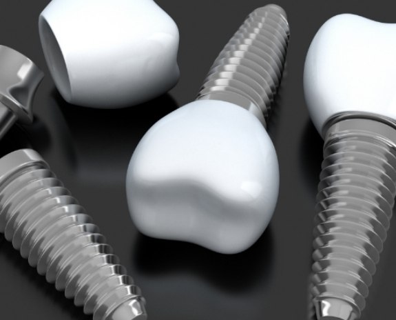 Closeup of animated dental implant supported replacement teeth