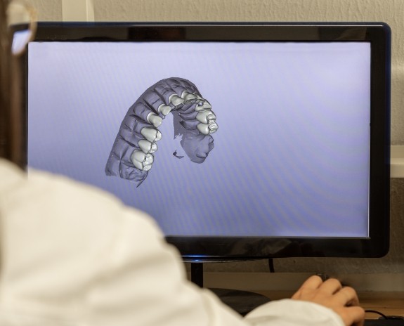 iTero digital impressions on chairside computer screen